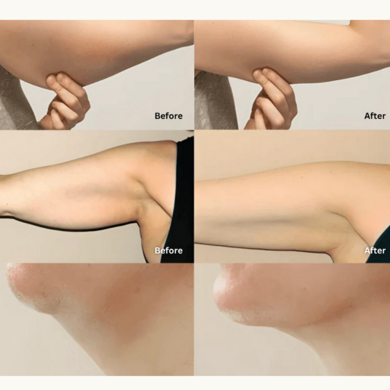 Femlora Ancient Lymphatic Drainage Elixir™